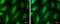 Protein Kinase D1 antibody, GTX133778, GeneTex, Immunofluorescence image 