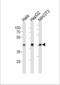 TATA-Box Binding Protein antibody, LS-C203916, Lifespan Biosciences, Western Blot image 