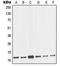NME/NM23 Nucleoside Diphosphate Kinase 2 antibody, LS-C352587, Lifespan Biosciences, Western Blot image 