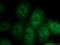 Sad1 And UNC84 Domain Containing 5 antibody, 17495-1-AP, Proteintech Group, Immunofluorescence image 
