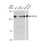 HSPH1 antibody, GTX03248, GeneTex, Western Blot image 