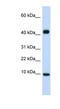 C-C Motif Chemokine Ligand 8 antibody, NBP1-79937, Novus Biologicals, Western Blot image 