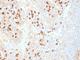 Plasma Cell Marker antibody, NBP2-45200, Novus Biologicals, Immunohistochemistry frozen image 