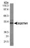 Sequestosome 1 antibody, TA336760, Origene, Western Blot image 