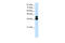 Forkhead Box J1 antibody, 28-774, ProSci, Enzyme Linked Immunosorbent Assay image 