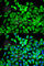 Eukaryotic initiation factor 4A-I antibody, A5294, ABclonal Technology, Immunofluorescence image 