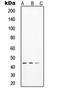 SRY-Box 17 antibody, LS-C353525, Lifespan Biosciences, Western Blot image 