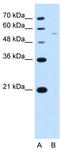 Arginine And Serine Rich Coiled-Coil 2 antibody, TA339889, Origene, Western Blot image 