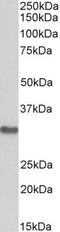 Microtubule Associated Protein RP/EB Family Member 3 antibody, orb20420, Biorbyt, Western Blot image 