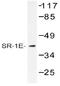 5-Hydroxytryptamine Receptor 1E antibody, AP20469PU-N, Origene, Western Blot image 