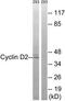 Cyclin D2 antibody, TA313567, Origene, Western Blot image 