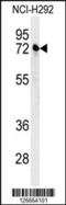 Kelch Like Family Member 24 antibody, 61-850, ProSci, Western Blot image 