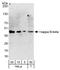 NFKB Inhibitor Beta antibody, A301-828A, Bethyl Labs, Western Blot image 