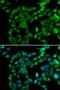 Protein Kinase AMP-Activated Non-Catalytic Subunit Beta 2 antibody, LS-C346153, Lifespan Biosciences, Immunofluorescence image 