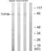 DNA Topoisomerase III Beta antibody, LS-C118743, Lifespan Biosciences, Western Blot image 