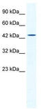 DMRT Like Family B With Proline Rich C-Terminal 1 antibody, TA341426, Origene, Western Blot image 
