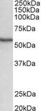 Serine/Threonine Kinase 38 antibody, PA5-37923, Invitrogen Antibodies, Western Blot image 