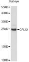 Complexin-4 antibody, LS-C749466, Lifespan Biosciences, Western Blot image 