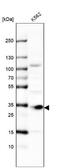 Metabolism Of Cobalamin Associated D antibody, NBP2-38351, Novus Biologicals, Western Blot image 