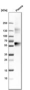 SERPINA1 antibody, HPA000927, Atlas Antibodies, Western Blot image 