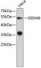 DEAD-Box Helicase 49 antibody, 23-856, ProSci, Western Blot image 