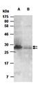 C-C Motif Chemokine Ligand 1 antibody, orb66704, Biorbyt, Western Blot image 