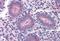 Elongator Acetyltransferase Complex Subunit 3 antibody, orb89998, Biorbyt, Immunohistochemistry paraffin image 