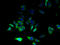 Cytochrome B-245 Chaperone 1 antibody, A67150-100, Epigentek, Immunofluorescence image 