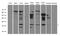 Ubiquitin Conjugating Enzyme E2 N Like (Gene/Pseudogene) antibody, A16722-1, Boster Biological Technology, Western Blot image 