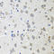 Alkaline Phosphatase, Biomineralization Associated antibody, LS-C331245, Lifespan Biosciences, Immunohistochemistry frozen image 