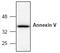 Annexin A5 antibody, AP00113PU-N, Origene, Western Blot image 