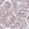 Unique cartilage matrix-associated protein antibody, HPA046718, Atlas Antibodies, Immunohistochemistry frozen image 