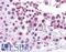 Protein Mdm4 antibody, LS-B4097, Lifespan Biosciences, Immunohistochemistry frozen image 