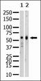 Lysine Methyltransferase 5A antibody, AM11037PU-N, Origene, Western Blot image 