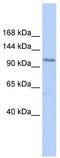 Transient Receptor Potential Cation Channel Subfamily C Member 3 antibody, TA344232, Origene, Western Blot image 
