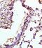 Vasoactive Intestinal Peptide Receptor 1 antibody, orb100402, Biorbyt, Immunohistochemistry paraffin image 