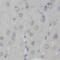 Protein Arginine Methyltransferase 8 antibody, FNab06793, FineTest, Immunohistochemistry frozen image 