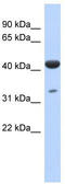 CDP-L-Ribitol Pyrophosphorylase A antibody, TA344255, Origene, Western Blot image 