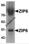 Zinc transporter ZIP6 antibody, 6091, ProSci Inc, Western Blot image 