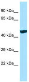Ankyrin Repeat Domain 33 antibody, TA334402, Origene, Western Blot image 