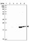 Calcium Regulated Heat Stable Protein 1 antibody, PA5-62515, Invitrogen Antibodies, Western Blot image 