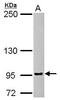 FGFR-2 antibody, PA5-29426, Invitrogen Antibodies, Western Blot image 