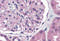 NPHS1 Adhesion Molecule, Nephrin antibody, 5615, ProSci, Immunohistochemistry paraffin image 