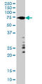 A-Raf Proto-Oncogene, Serine/Threonine Kinase antibody, LS-C196681, Lifespan Biosciences, Western Blot image 