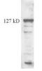 Telomerase Reverse Transcriptase antibody, GTX30410, GeneTex, Western Blot image 