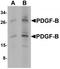 Platelet Derived Growth Factor Subunit B antibody, TA319694, Origene, Western Blot image 