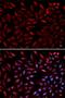 Proteasome 26S Subunit, ATPase 2 antibody, orb167138, Biorbyt, Immunofluorescence image 