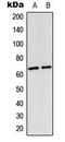 p65 antibody, MBS8213602, MyBioSource, Western Blot image 