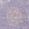 Derlin 2 antibody, PA5-63318, Invitrogen Antibodies, Immunohistochemistry frozen image 