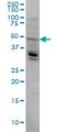 LAG1 longevity assurance homolog 4 antibody, H00079603-M04, Novus Biologicals, Western Blot image 